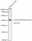 α-Smooth Muscle Actin (ACTA2) Rabbit pAb (A1011)