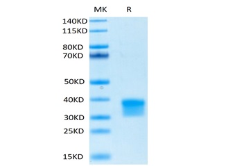 Biotinylated Recombinant Human Oncostatin-M/OSM Protein (RP02464)
