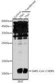 SARS-CoV-2 NSP6 Rabbit pAb (A20322)