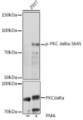 Phospho-PRKCD-S645 Antibody kit (RK05806)
