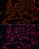 ABCB11 Rabbit pAb (A14694)