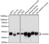 [One Step]ALDOA Antibody Kit (RK05621)