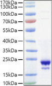 Recombinant Mouse IL-10 Protein (RP01465)
