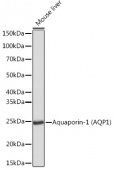 Антитела моноклональные кроличьи к Аквапорину-1 (AQP1) (Aquaporin-1 (AQP1) Rabbit mAb), ABclonal