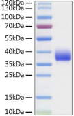 Recombinant SARS-CoV Spike RBD  Protein (RP01299)