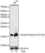 Acetyl-Histone H3-K18 Rabbit pAb (A7257)