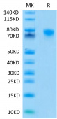 Recombinant Human TNFRSF1B/TNF-R2/CD120b Protein (RP02079)