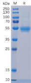 Recombinant Human IL-5RA/CD125 Protein (RP02235)
