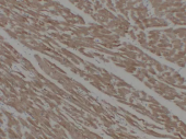 Anti -ACTC1 Mouse mAb