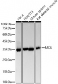 [KO Validated] MCU Rabbit mAb (A22525)