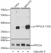 Phospho-PPP1CA-T320 Antibody kit (RK04085)