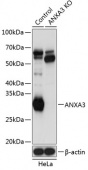 [KO Validated] ANXA3 Rabbit pAb (A19861)