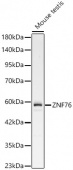 ZNF76 Rabbit pAb (A24491)