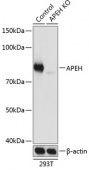 [KO Validated] APEH Rabbit pAb (A19912)