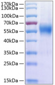 Active Recombinant Human IL-17RA/CD217 Protein (RP00273)