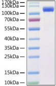 Recombinant SARS-CoV Spike RBD  Protein (RP01304)