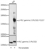 Phospho-PLCG2-Y1217 Antibody kit (RK04094)