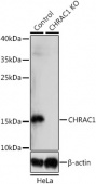 [KO Validated] CHRAC1 Rabbit pAb (A14896)