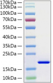 Recombinant Human IL-21 Protein (RP01312)