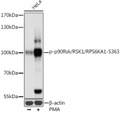 Phospho-RPS6KA1-S363 Antibody kit (RK04083)