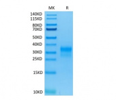 Recombinant Human ErbB-2/HER2/CD340 (Domain IV) Protein (RP02377)