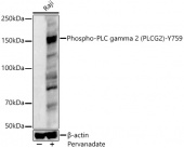 Phospho-PLCG2-Y759 Antibody kit (RK04095)
