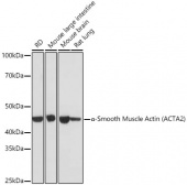 α-Smooth Muscle Actin (ACTA2) Rabbit mAb (A17910)
