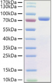 Recombinant Human CDH1/E-Cadherin/CD324 Protein (RP01421)