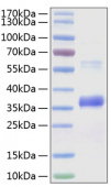 Рекомбинантный Noggin человека (Recombinant Human Noggin/NOG Protein), ABclonal