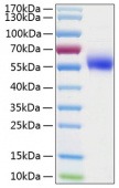 Recombinant Human IL-1R2/IL-1RT2/CD121b Protein (RP01028)