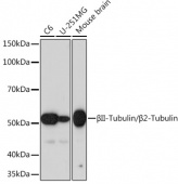 βII-Tubulin/β2-Tubulin Rabbit mAb (A4798)