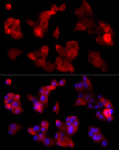ABCA1 Rabbit mAb (A21976)