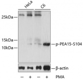 Phospho-PEA15-S104 Antibody kit (RK05768)