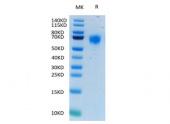 Recombinant Human FGFR-4/CD334 Protein (RP02356)
