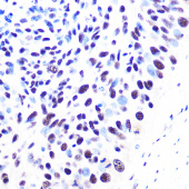 53BP1 Rabbit mAb (A3859)