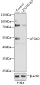 [KO Validated] ATG4D Rabbit pAb (A18097)