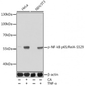 Phospho-RELA-S529 Antibody kit (RK05785)