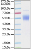 Recombinant Human IL-3RA/CD123 Protein (RP00121)