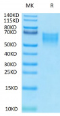 Biotinylated Recombinant Human B7-2/CD86 Protein (RP02279)