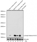 Acetyl-Histone H4-K5 Rabbit mAb (A19525)