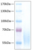 Active Recombinant Human CEACAM-1/CD66a Protein (RP00294)