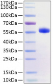 Recombinant Human TNFRSF5/CD40 Protein (RP01218)