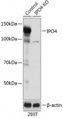 [KO Validated] IPO4 Rabbit pAb (A19902)