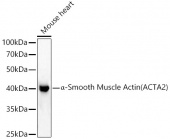 α-Smooth Muscle Actin (ACTA2) Rabbit pAb (A7248)