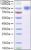 Recombinant Human TNFRSF21/DR6 Protein (RP01349)