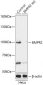 [KO Validated] BMPR2 Rabbit pAb (A18079)