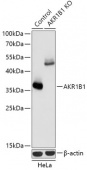 [KO Validated] AKR1B1 Rabbit pAb (A18031)