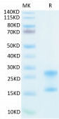 Recombinant Human IL-17A&IL-17F Protein (RP02414)