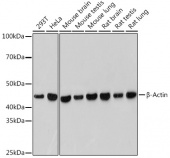 β-Actin Rabbit mAb (AC038)