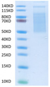 Recombinant Human TNFSF7/CD27 Ligand Protein (RP02032)